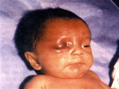 LA VIOLENCIA CONTRA LOS NI&Ntilde;OS.